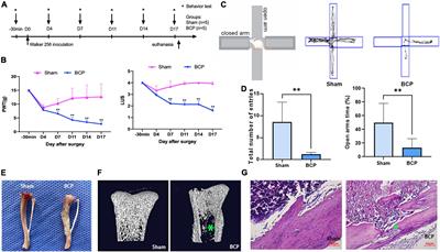 Neuroinflammation in the medial prefrontal cortex exerts a crucial role in bone cancer pain